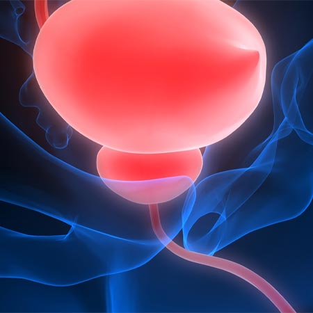 Prostate Treatment in Vijayawada